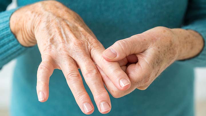 Ningún remedio es tan efectivo para curar la artritis como la cúrcuma con jengibre. Excelente remedio