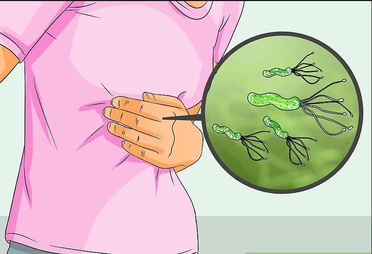 Como eliminar la bacteria helicobacter pilory