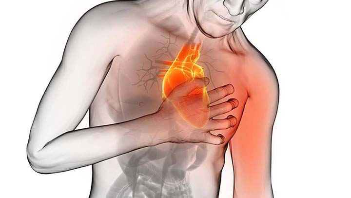 Estos son los 8 síntomas previos que aparecen 1 mes antes de un ataque al corazón